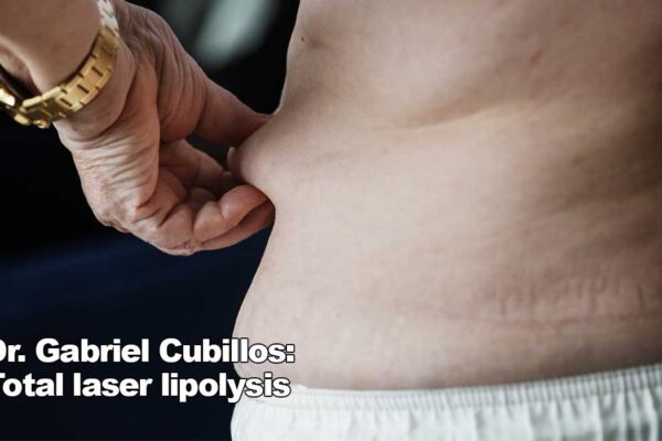 Dr. Gabriel Cubillos: Ultra-definition laser lipolysis in Anguilla