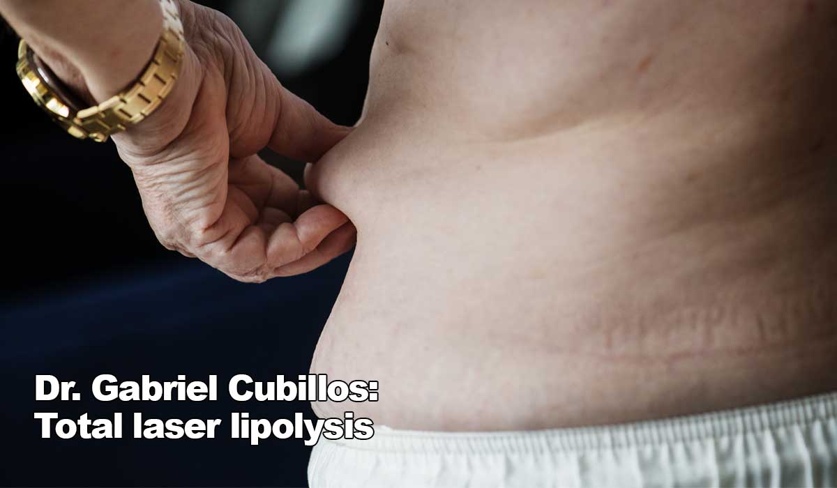 Dr. Gabriel Cubillos: Total laser lipolysis in Jamaica